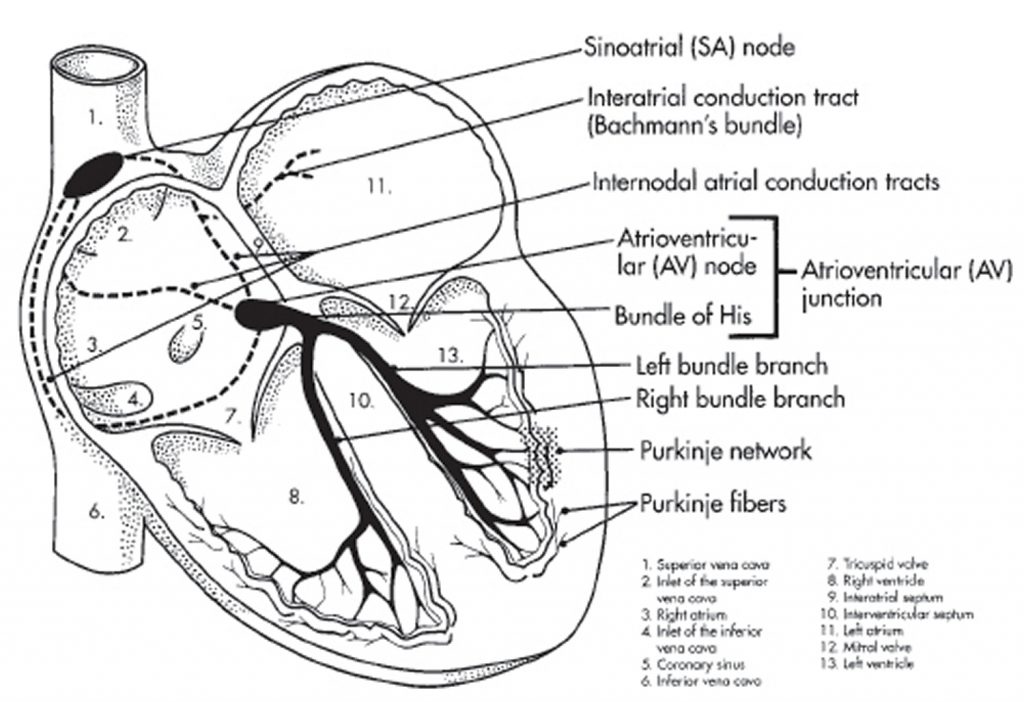 Bifascicular Block Causes Symptoms Diagnosis Treatment