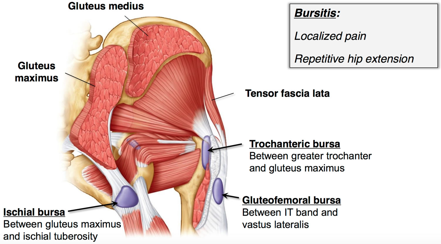Bursitis Hip Trochanteric Knee Shoulder Elbow Causes Treatment