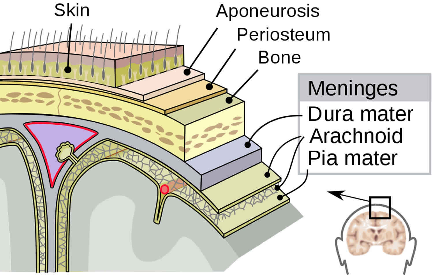 Epidural Hematoma Causes Signs Symptoms Diagnosis Treatment