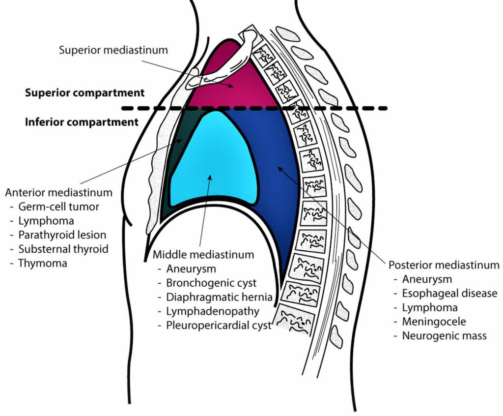 Mediastinum Anatomy Location Cavity Organs Function Tumors