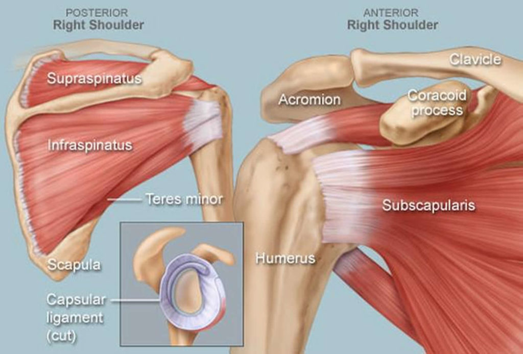 Calcific Tendinosis Causes Symptoms Diagnosis Treatment Prognosis