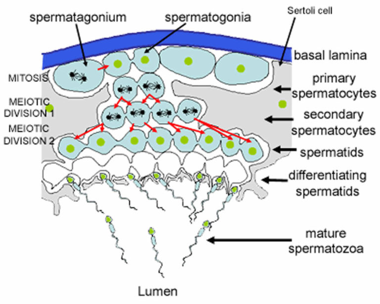 Leydig Cell Tumor Causes Symptoms Diagnosis Treatment Prognosis