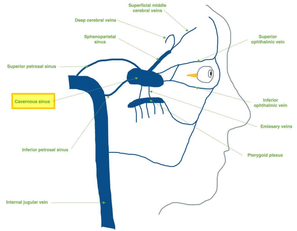 Cavernous Sinus Syndrome Causes Signs Symptoms Diagnosis Treatment