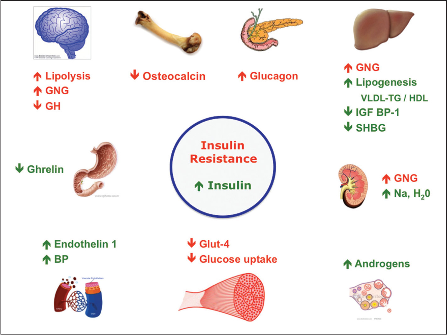 what-is-insulin-resistance-what-causes-insulin-resistance