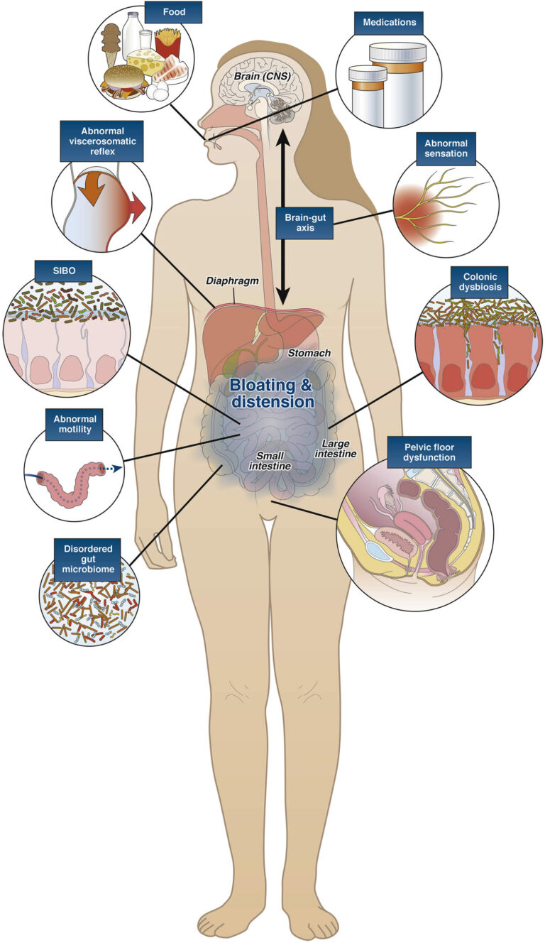 Learn What Causes Stomach Bloating and How To Get Rid of Bloating