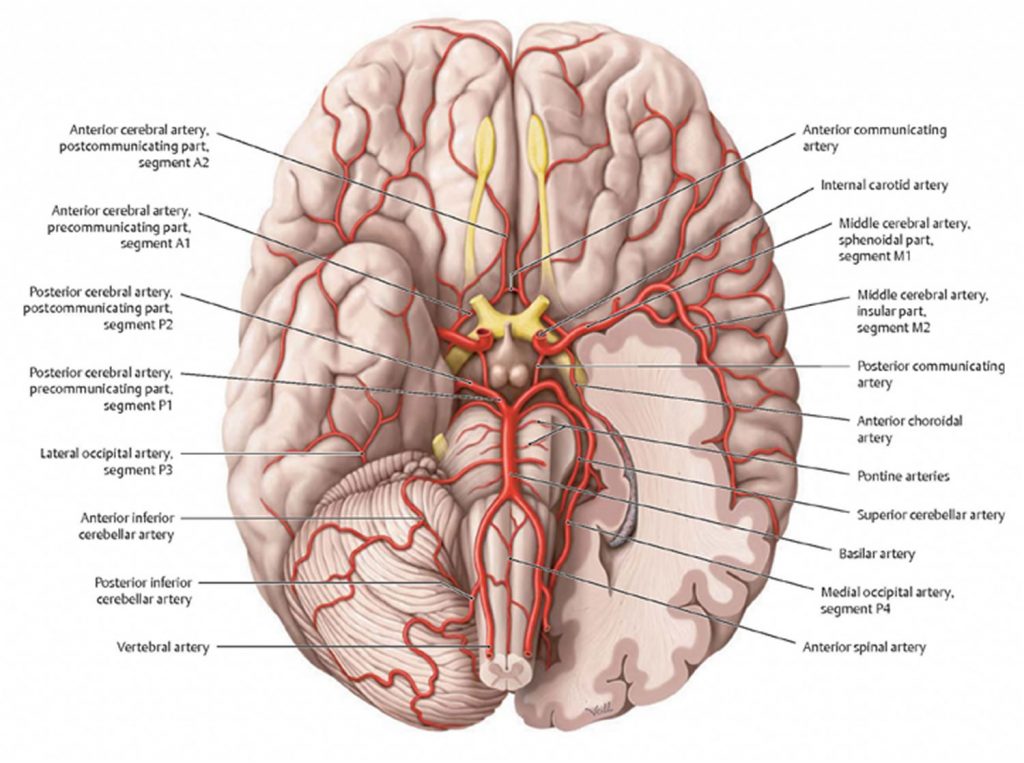 What is Vascular Dementia Symptoms, Causes, Stages & Life Expectancy