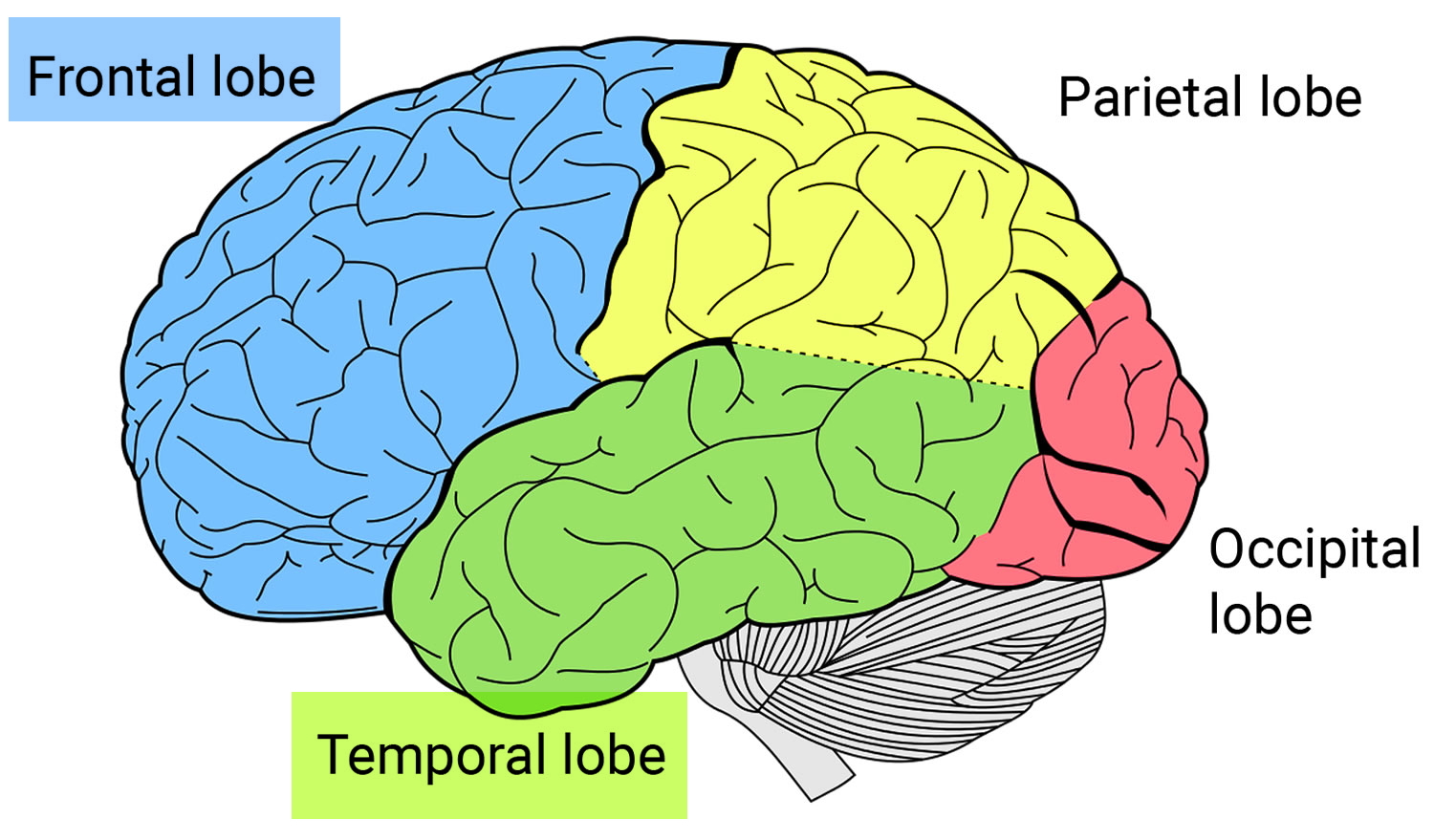 frontotemporal lobes dementia