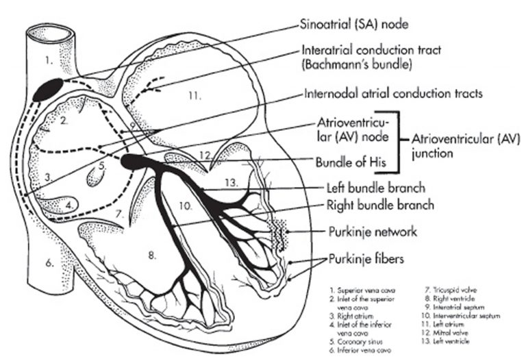 Bifascicular block causes, symptoms, diagnosis & treatment