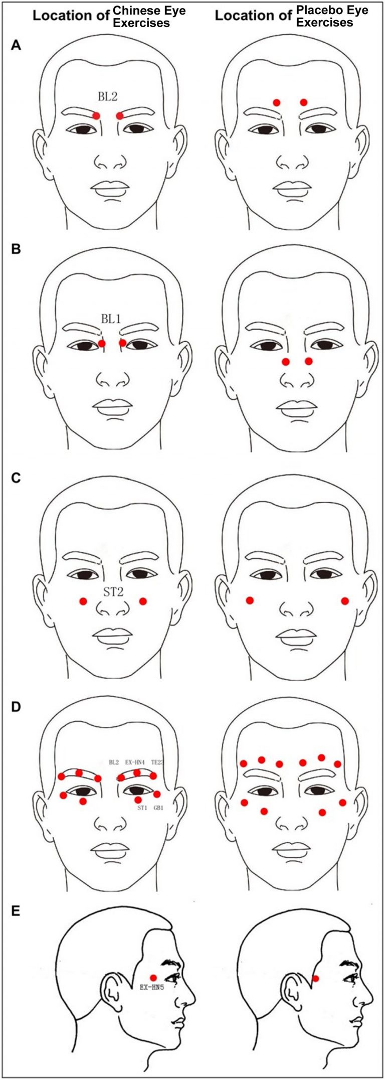 Eye Exercises to Improve Vision - Do They Work