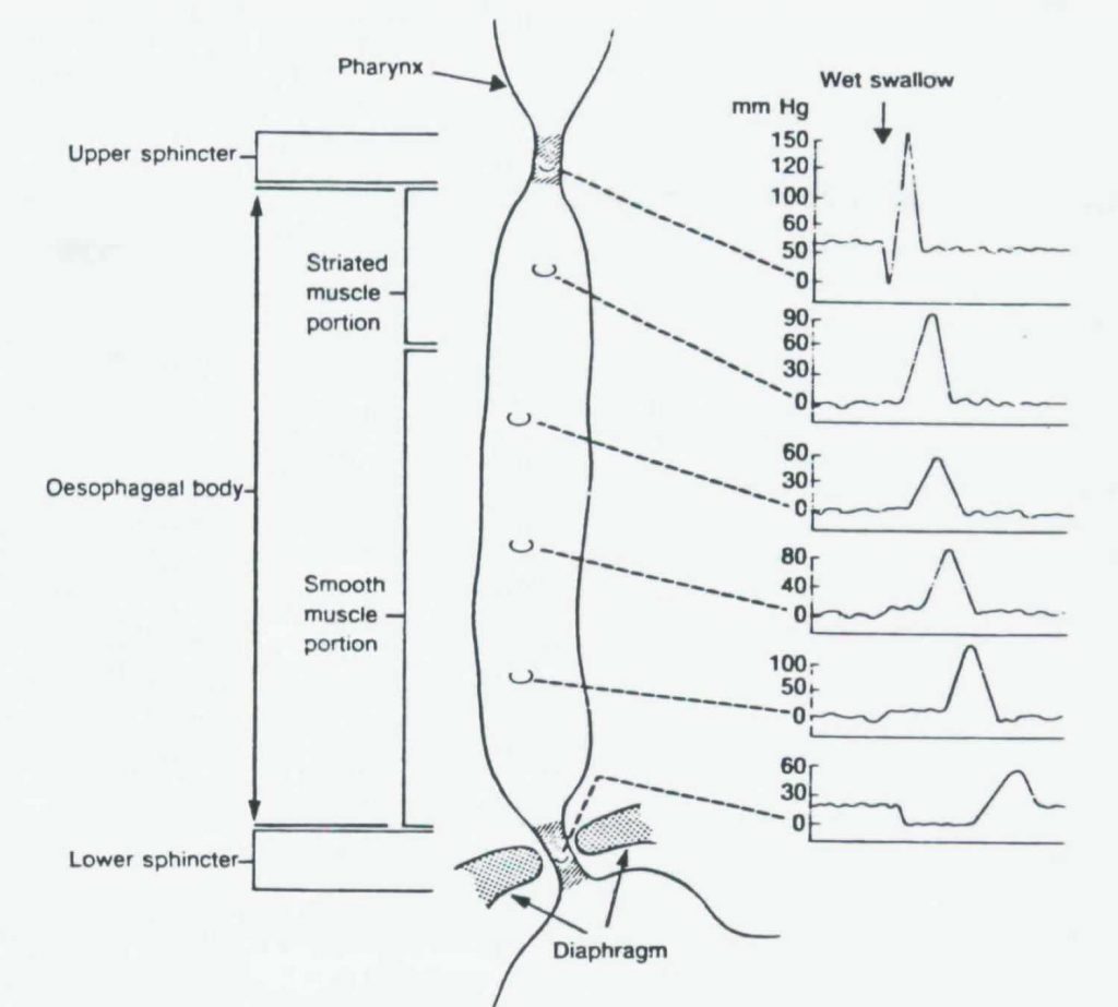 Nutcracker Esophagus Symptoms, Diagnosis and Treatment