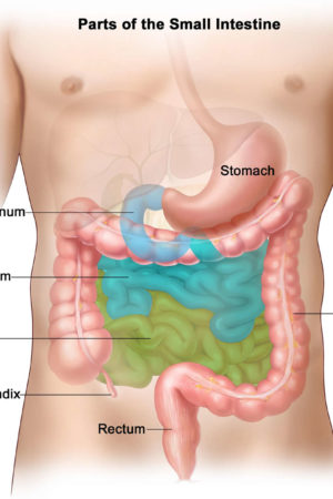 small intestine cancer
