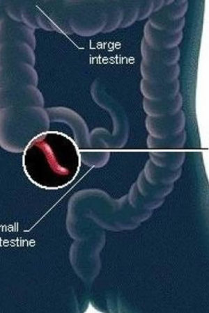 appendix