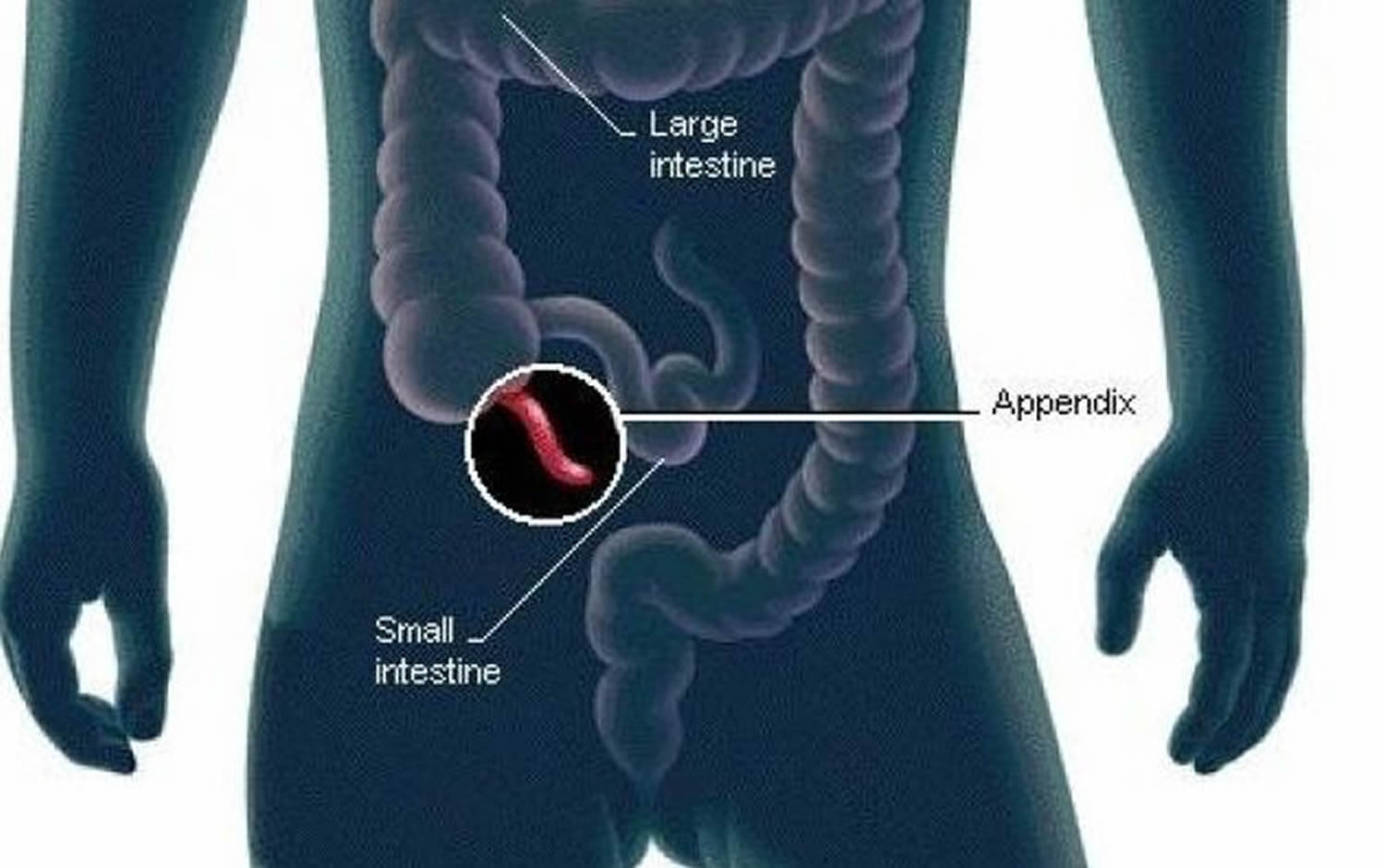 Human Appendix Anatomy, Location and Function of Appendix