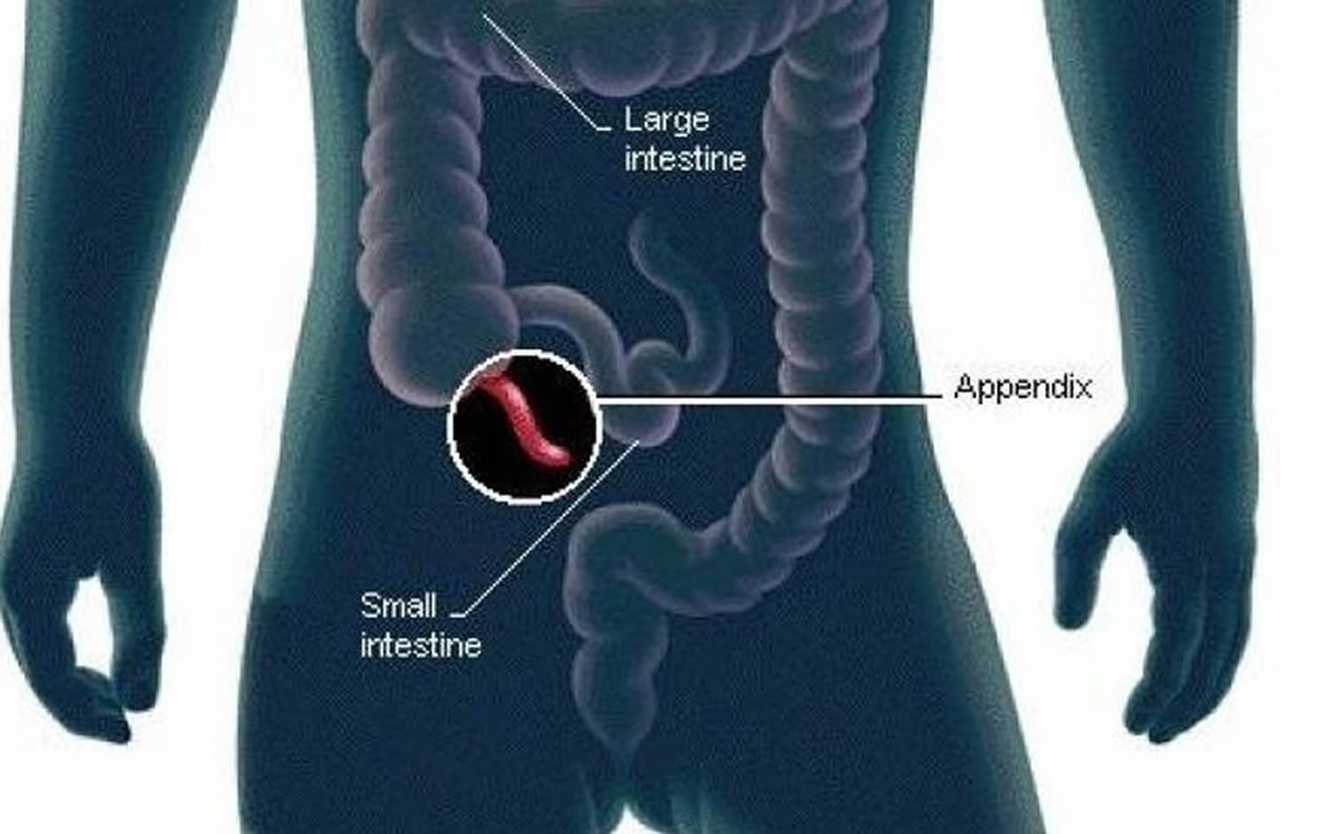 Human Appendix Anatomy Location And Function Of Appendix 