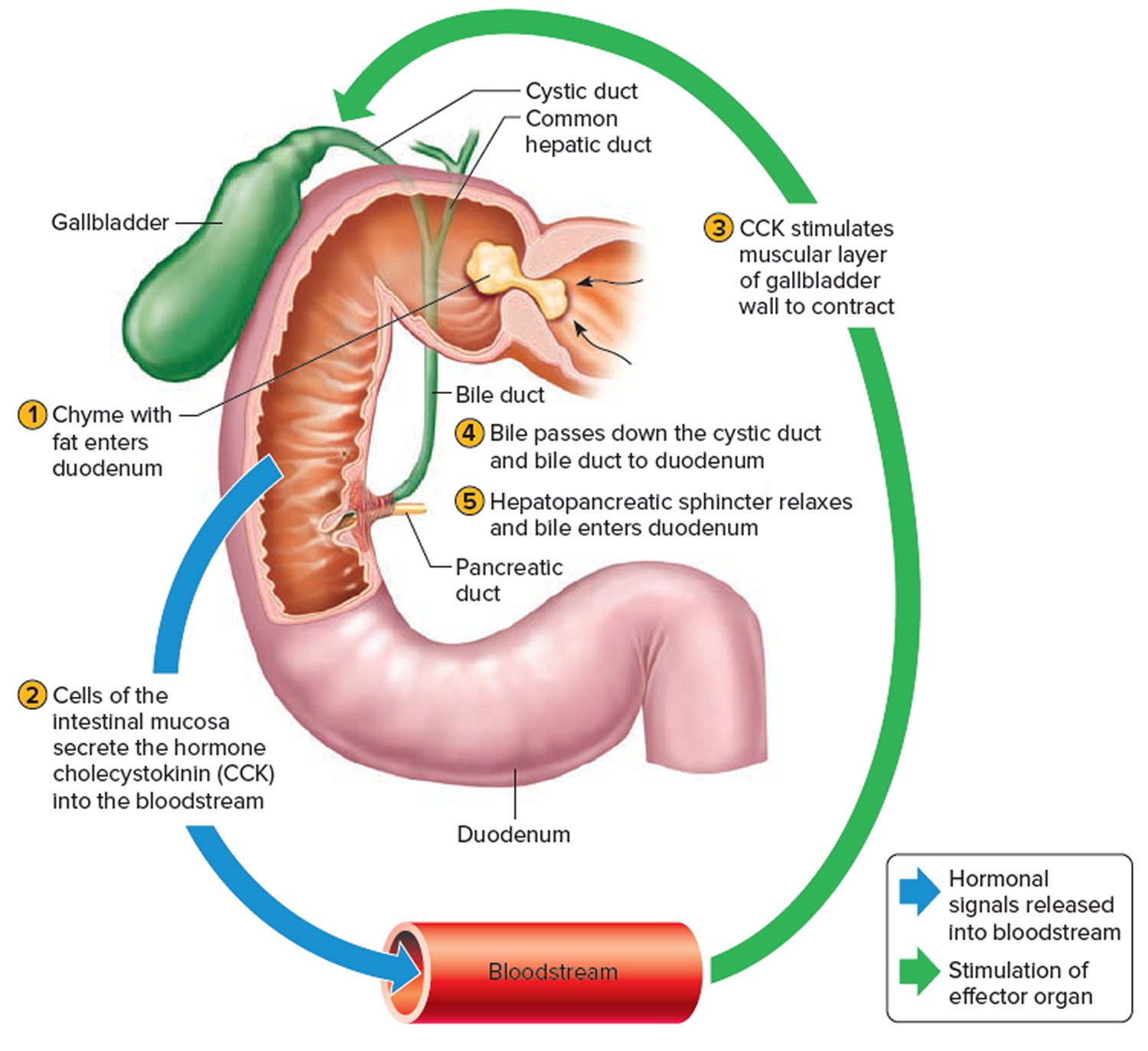 biliary-colic-causes-symptoms-diagnosis-treatment-prognosis