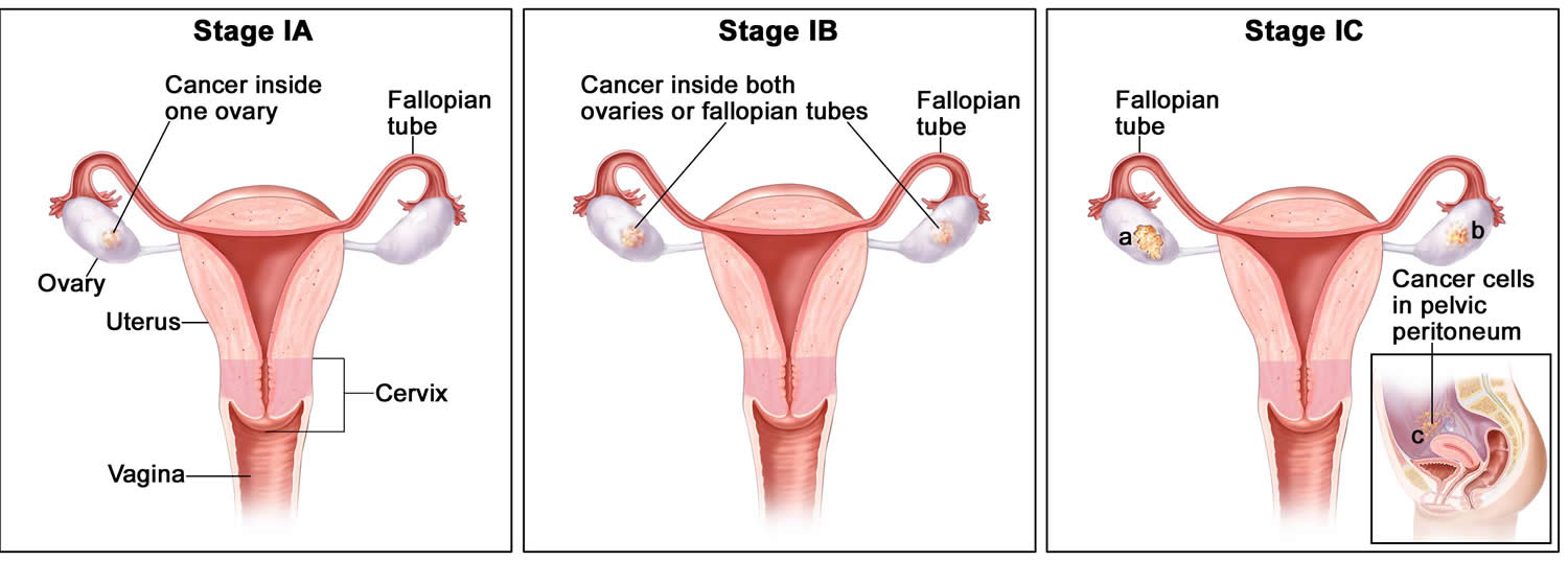 fallopian-tube-function-pregnancy-blocked-fallopian-tube