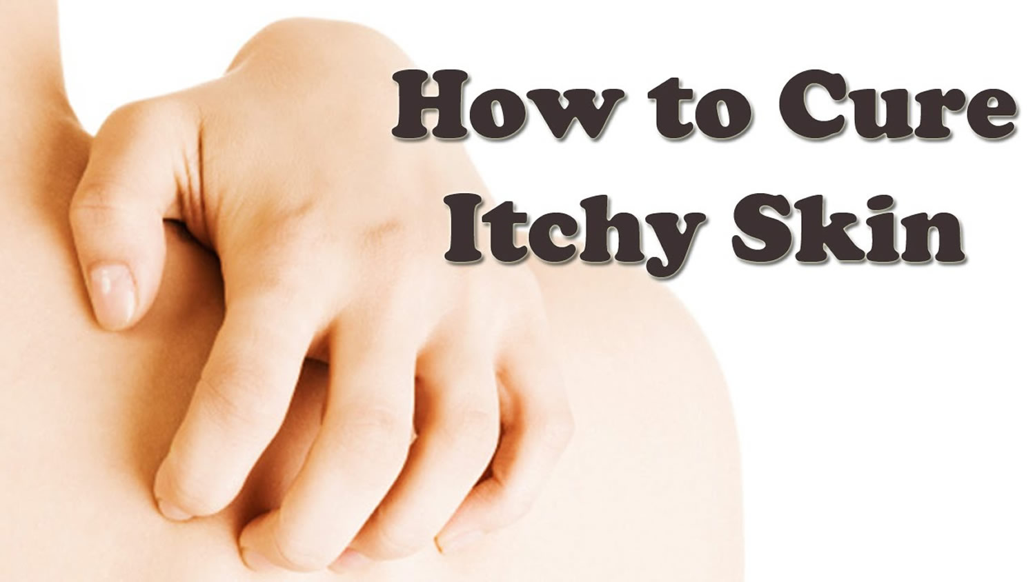 itchy skin tags