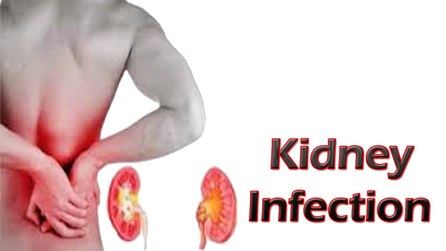 top-4-stages-of-passing-a-kidney-stone