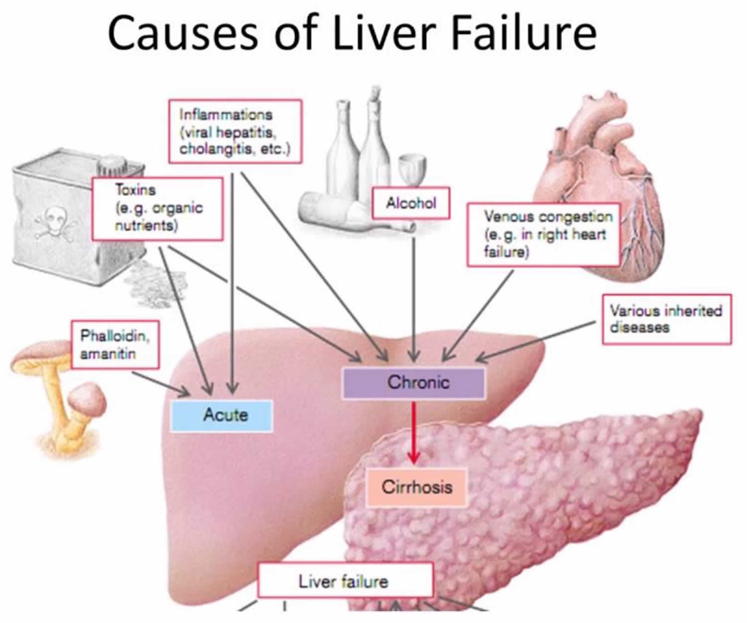 Does Liver Failure Cause Face Swelling