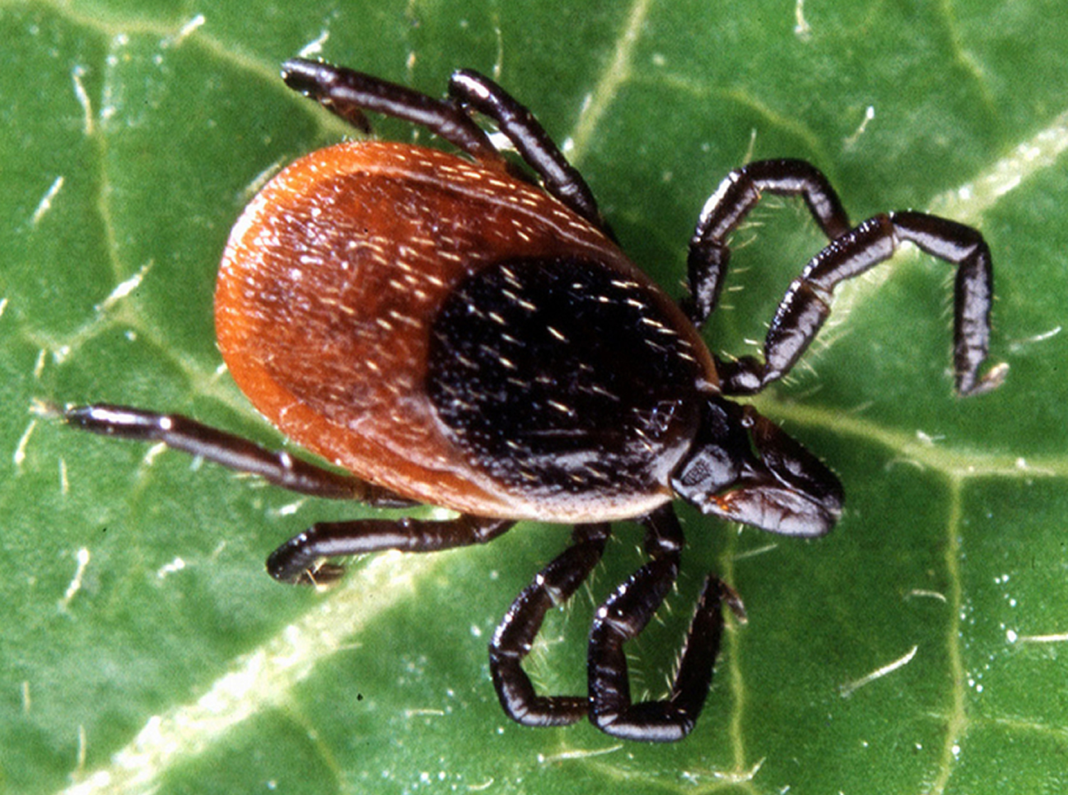 Lyme Disease Rash, Causes, Symptoms, Diagnosis and Treatment