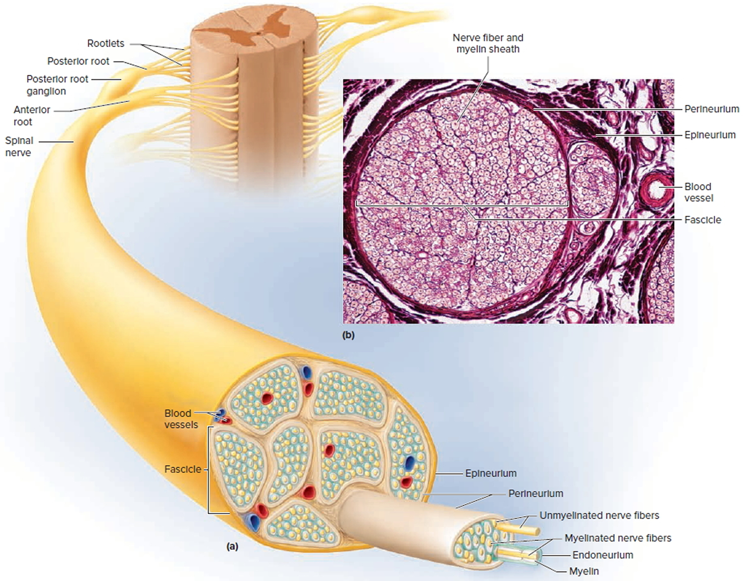 Lower motor neuron lesion, causes, signs & symptoms