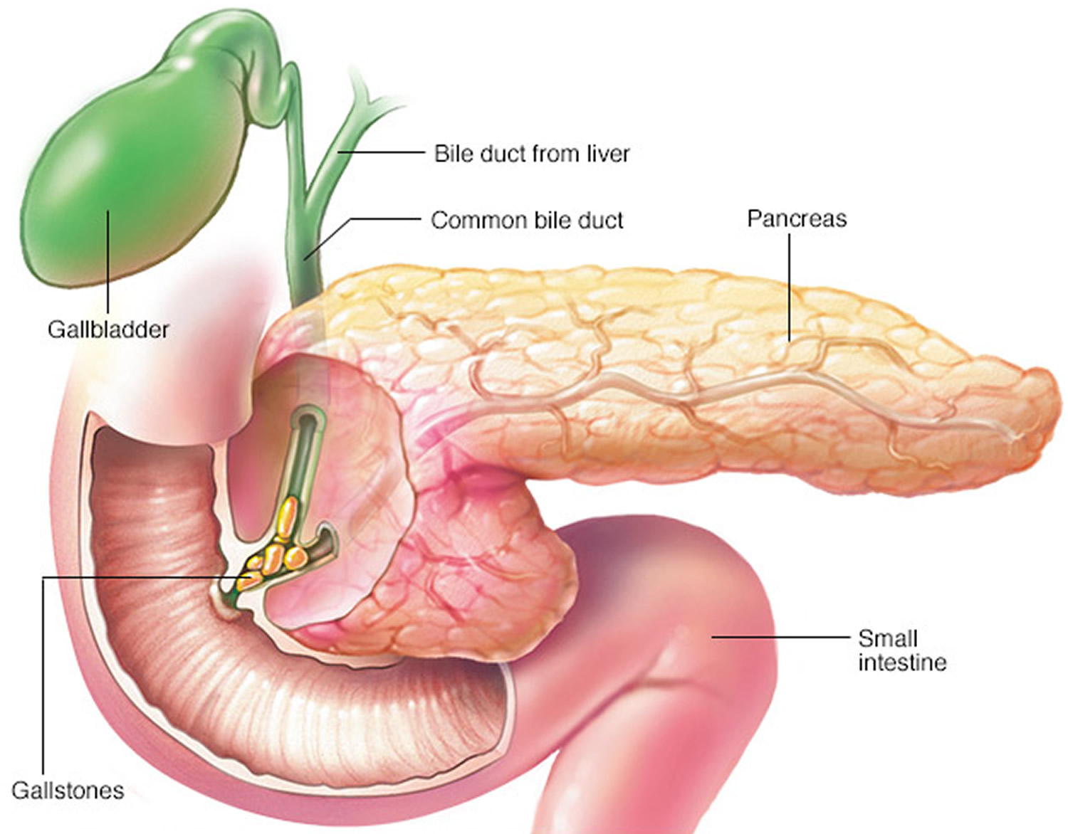 pancreatitis-symptoms-causes-treatment-vrogue-co