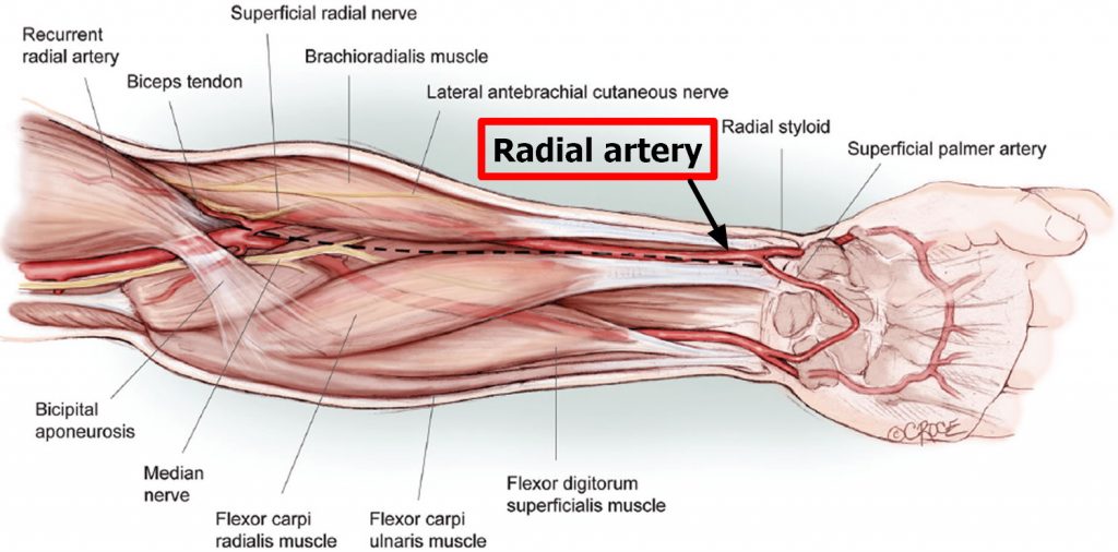 Radial Artery - Location in the Arm for Radial Artery Catheterization