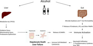 Acute Alcoholic Hepatitis Symptoms, Prognosis, Treatment And Recovery