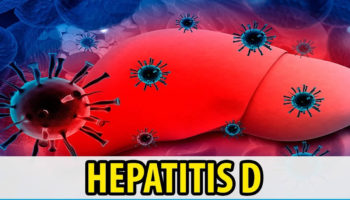 hepatitis d