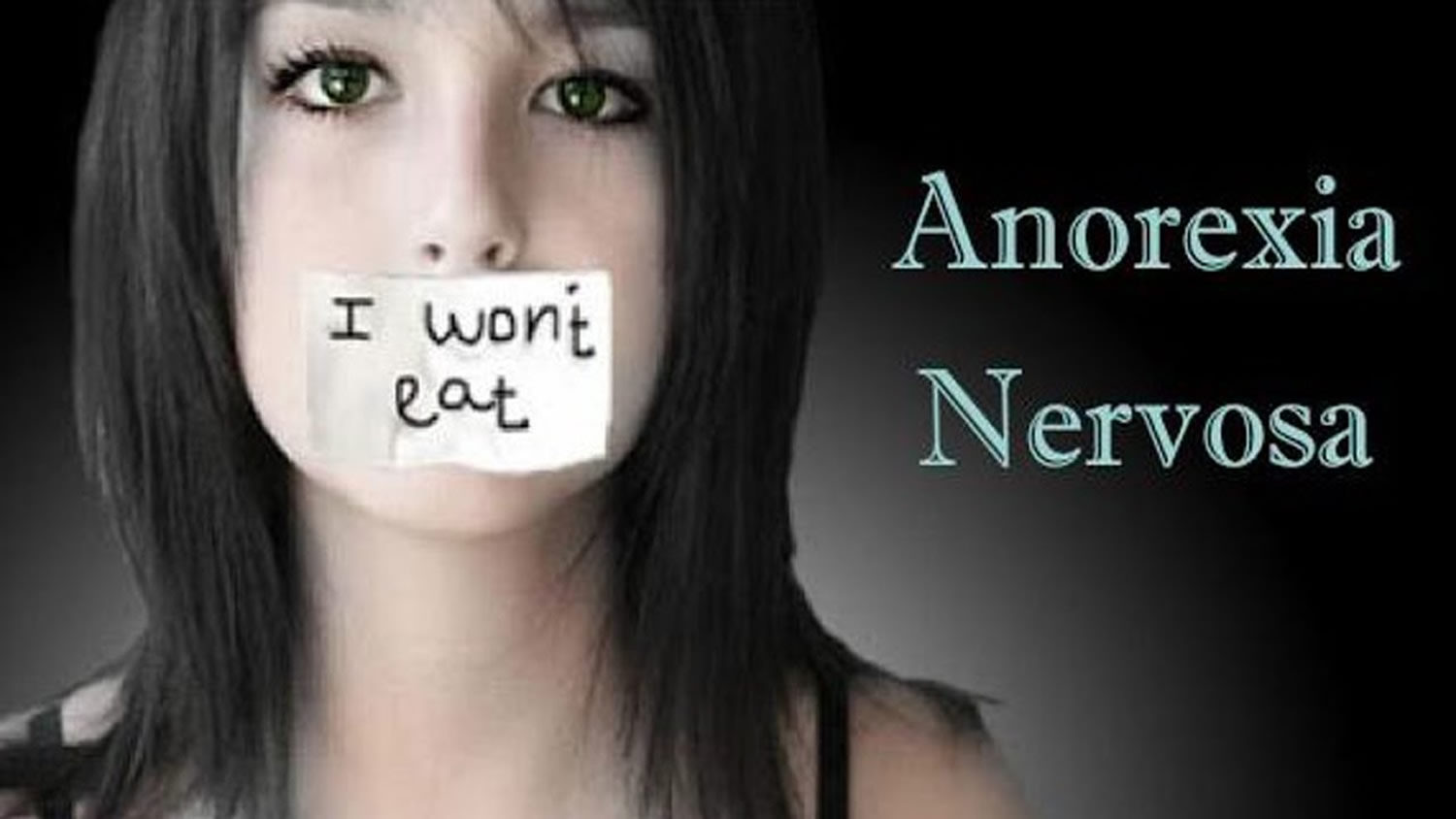 anorexia nervosa 5150