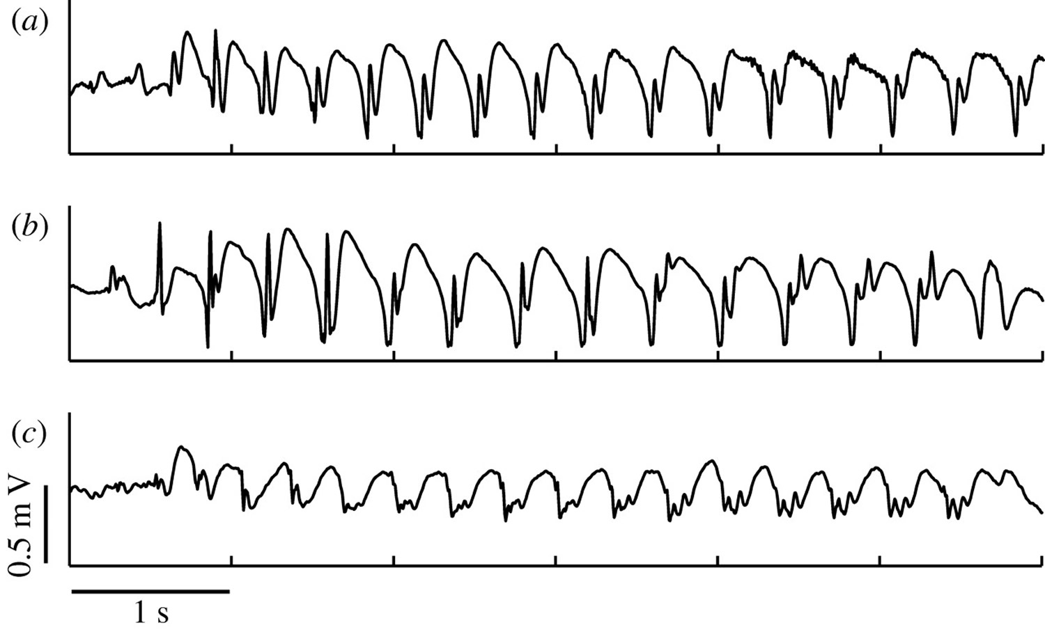 Спайки на ээг. Спайк волна на ЭЭГ. EEG зубец. Спайк волна и пик волна. Полиспайк-волновые паттерны,.