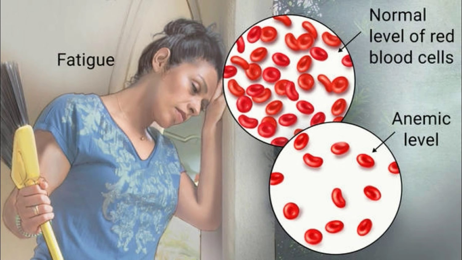 anemia-causes-types-signs-symptoms-diagnosis-test-treatment