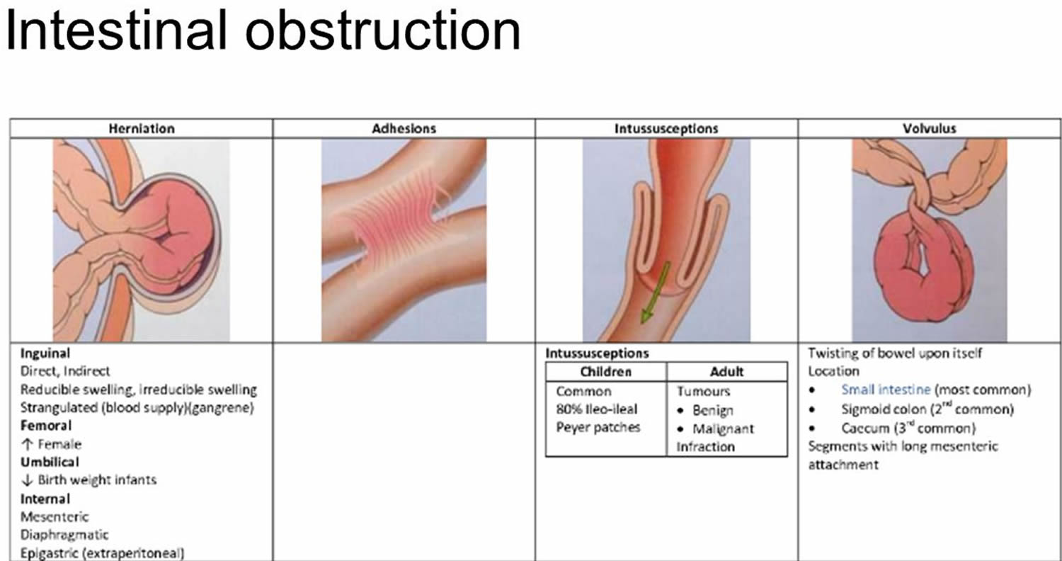 What Is A Mechanical Small Bowel Obstruction