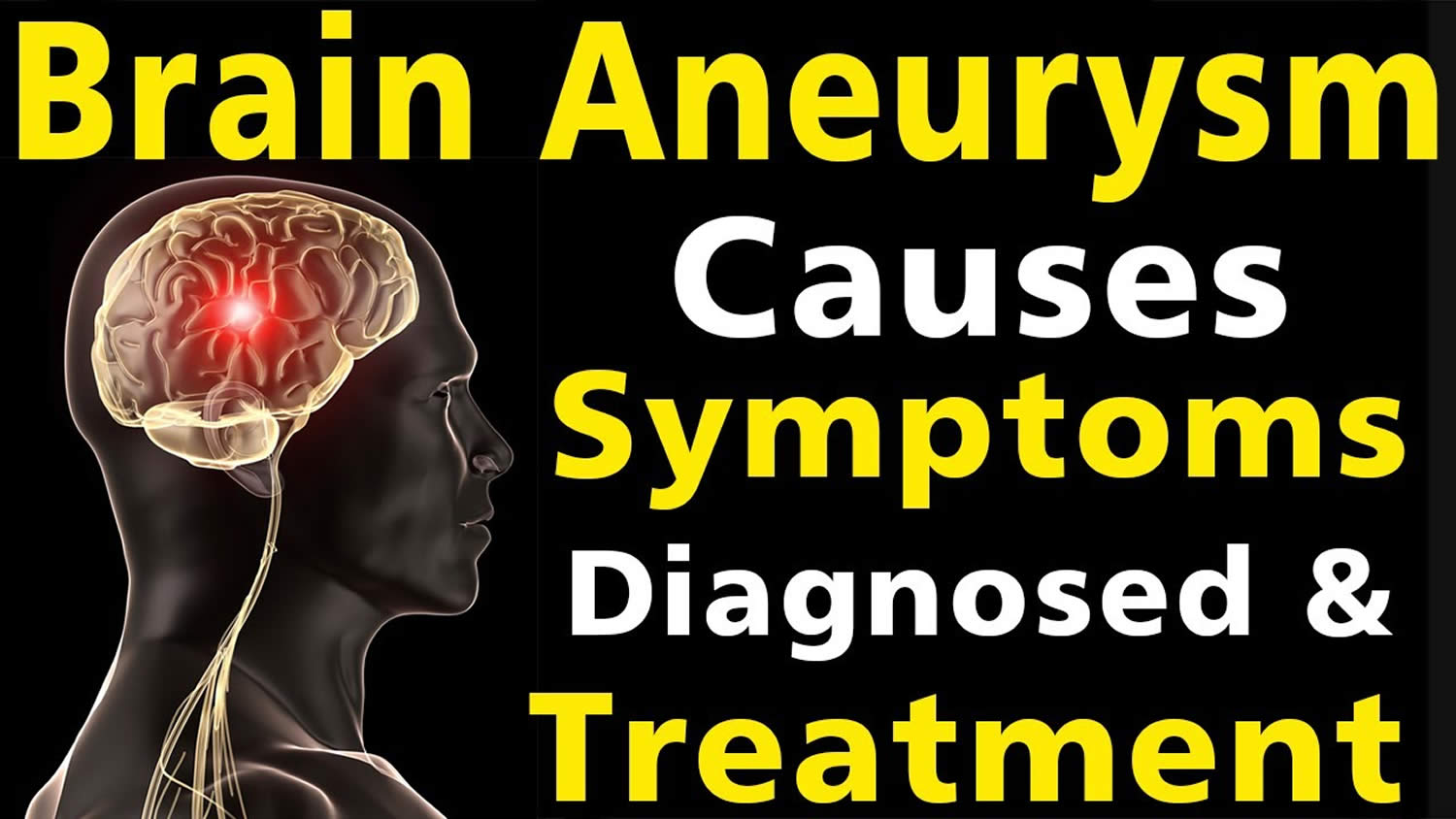Brain Aneurysm Causes Symptoms Warning Signs Treatmen - vrogue.co