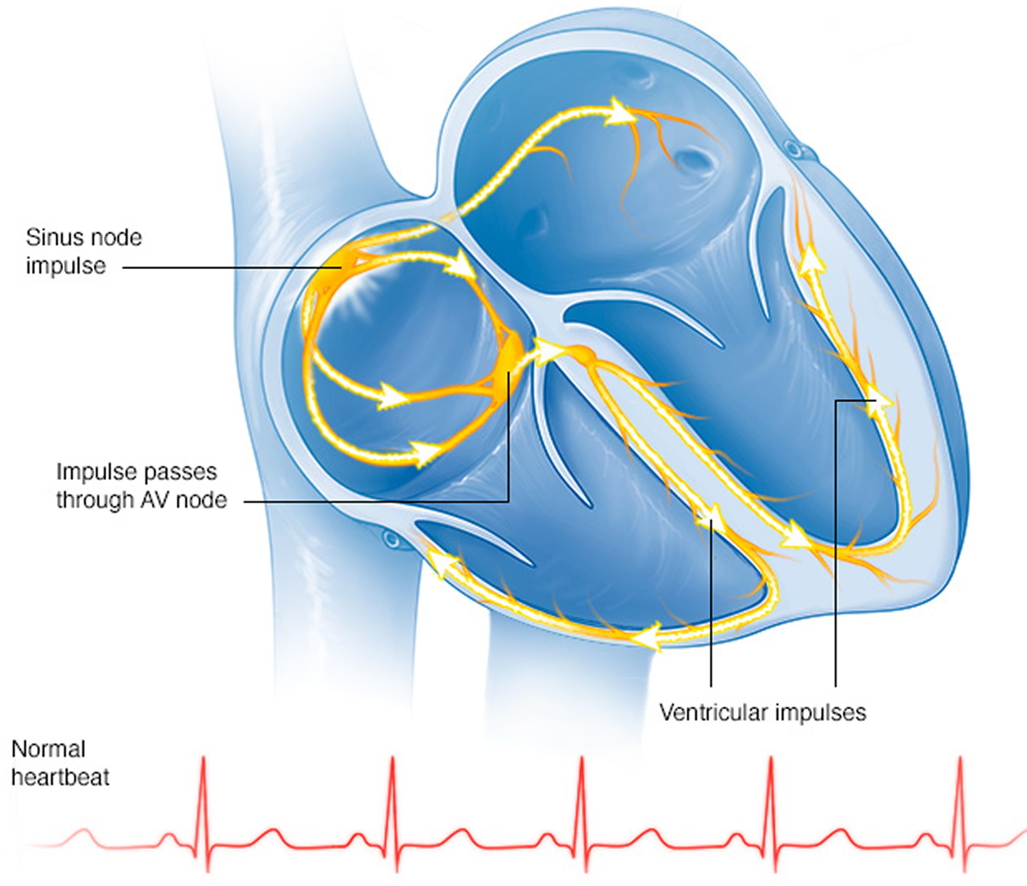 What Causes Sick Sinus Syndrome In Young Adults