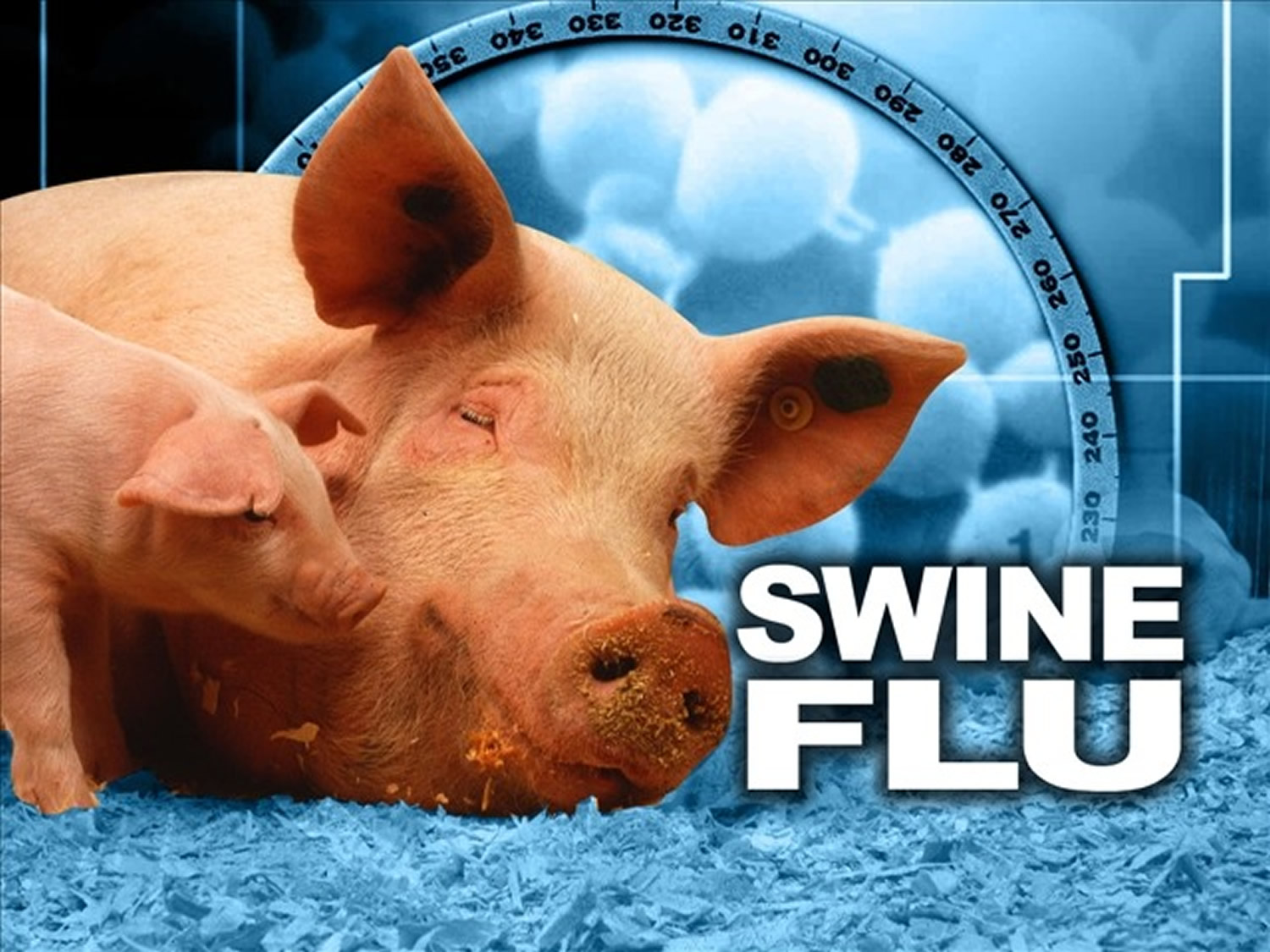 Swine Flu - H1N1 Virus - Symptoms, Vaccine, Treatment