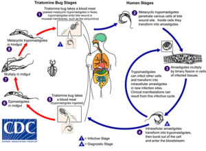 Chagas Disease - Parasite, Symptoms, Complications, Treatment