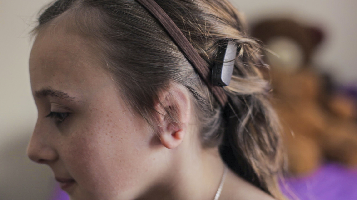 Hearing Loss Bilateral Unilateral Hearing Loss Causes & Treatment