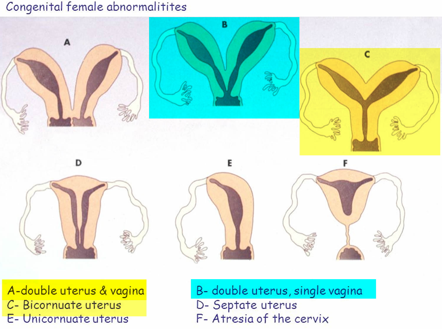 Double Uterus Causes Symptoms Complications