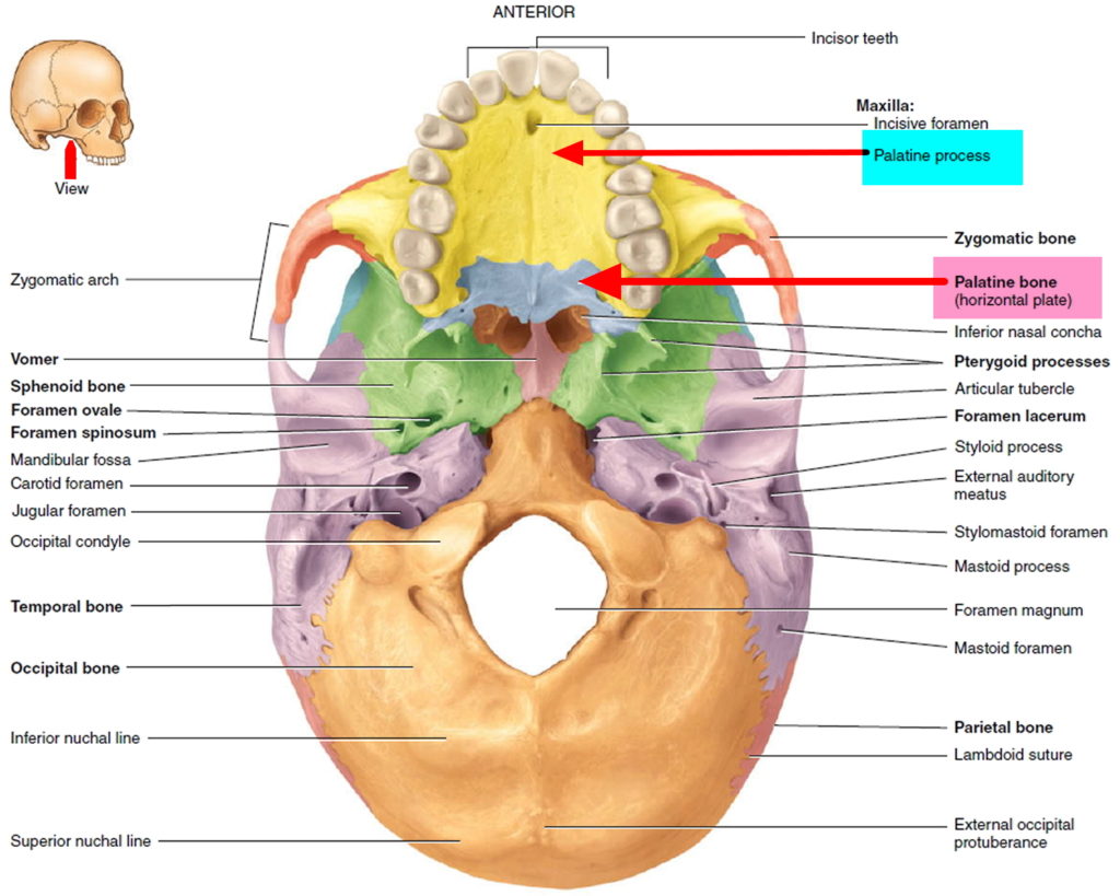 Cleft Palate & Cleft Lip - Causes, Symptoms, Repair, Surgery