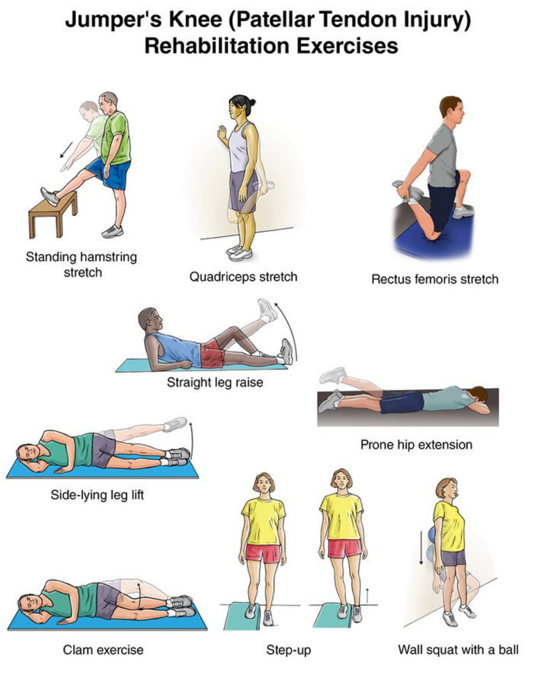 Patellar Tendinitis - Causes, Symptoms, Stretching, Exercises, Treatments