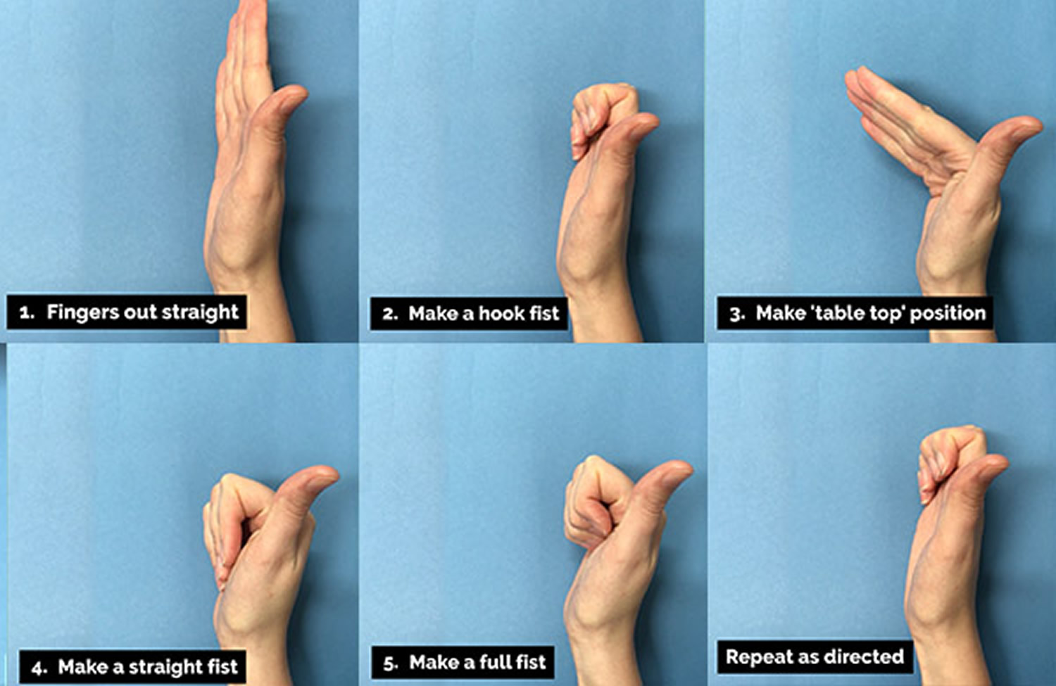 Trigger Finger Exercises Pdf Nhs at Scott Garcia blog