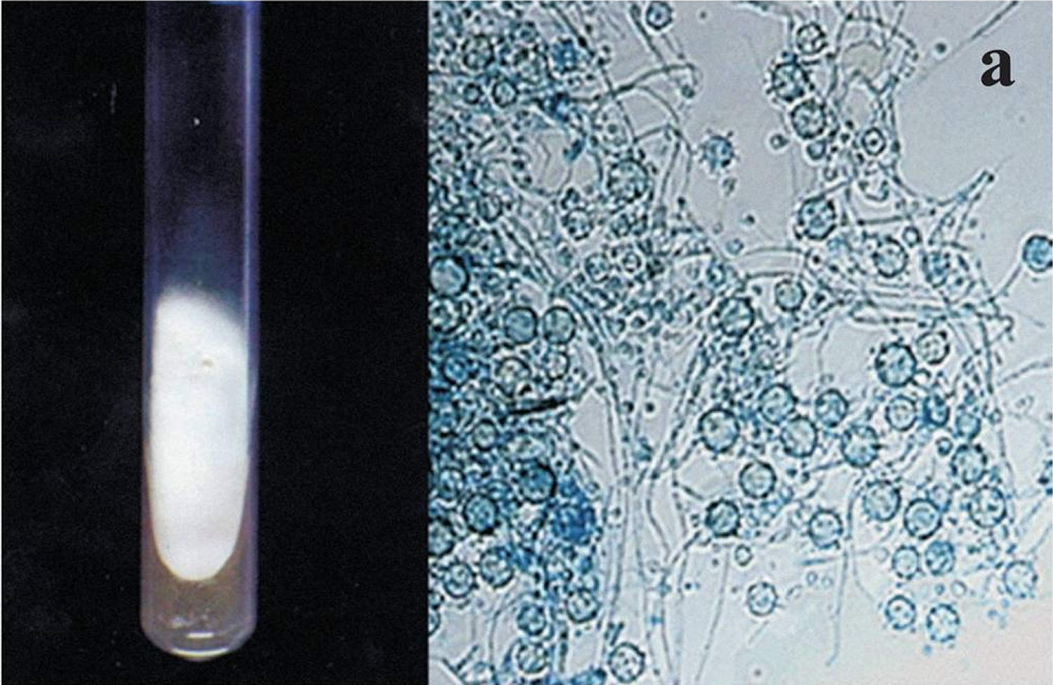 Масло для микроскопии. Histoplasma capsulatum микроскопия. Гистоплазмоз капсулатум. Строение Histoplasma SPP. Гистоплазмоз возбудитель.