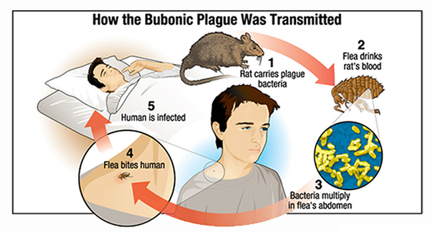 Plague Bubonic Plague Black Plague Causes, Symptoms, Treatment