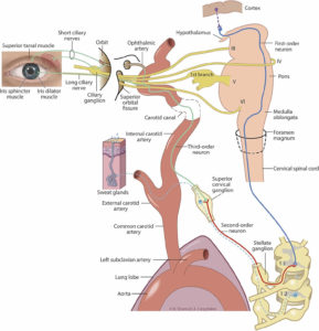 Horner's Syndrome - Causes, Signs & Symptoms, Diagnosis, Treatment