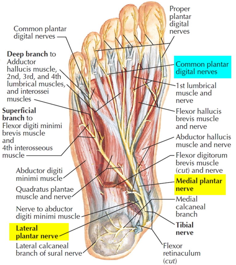 Morton's Neuroma - Causes, Symptoms, Diagnosis, Treatment