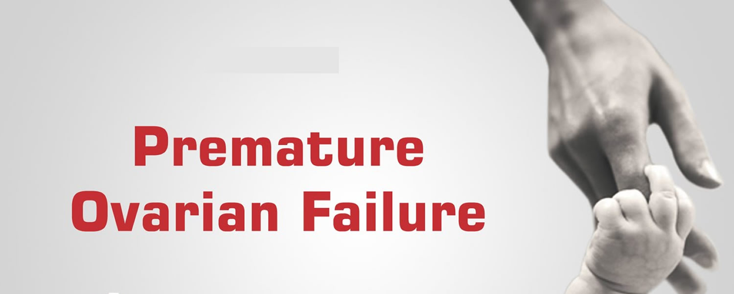 Premature Ovarian Failure Causes Symptoms Diagnosis Treatment