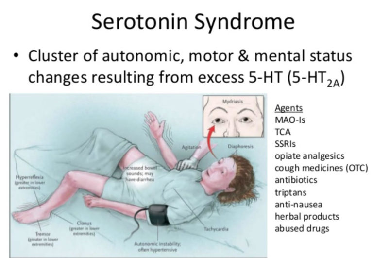 serotonin-syndrome-causes-signs-symptoms-duration-treatment