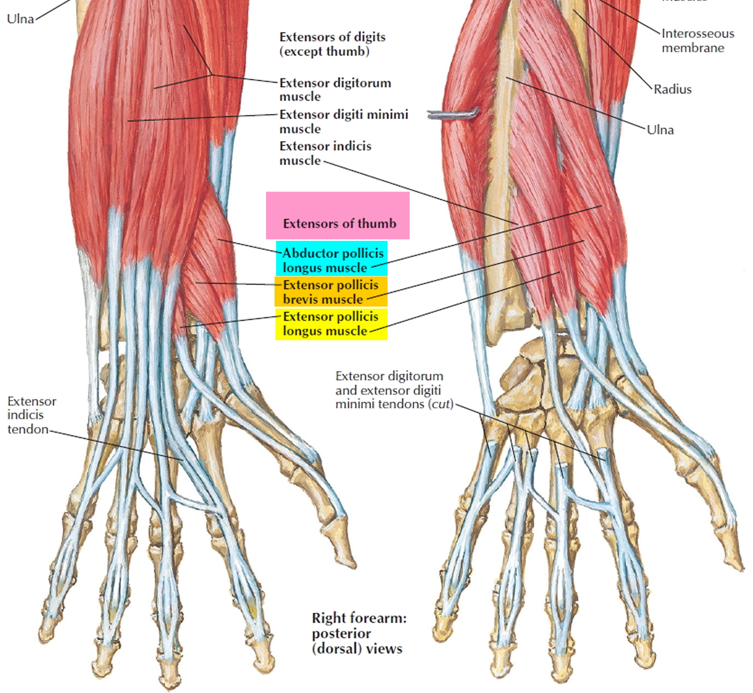 Flexor Tendon Tenosynovitis