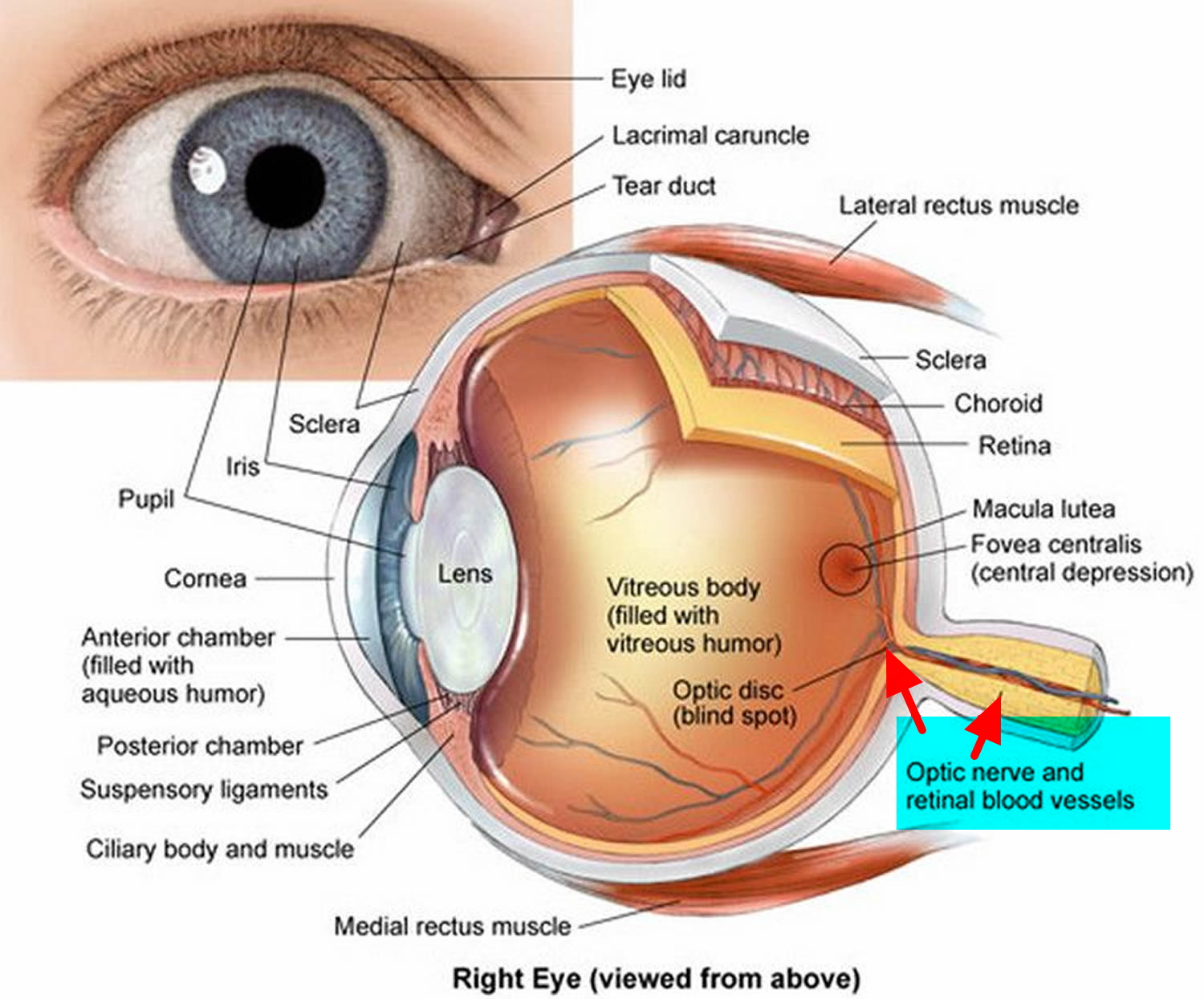 What Is A Small Optic Nerve